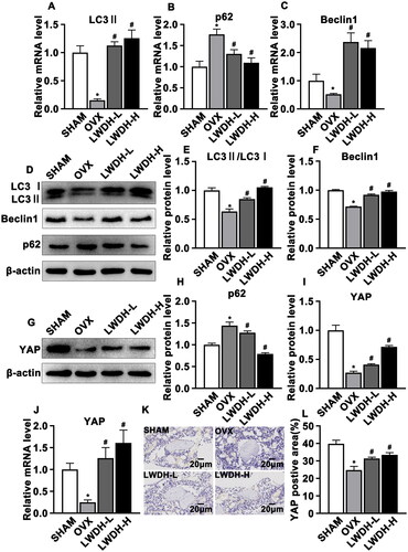 Figure 6. LWDH can maintain BMSCs autophagy levels in OVX rats. (A-C) BMSCs of each group were subjected to qRT-PCR to detect the expression of LC3II, p62 and Beclin1 mRNA (n = 6). (D-F, H) The expression and quantitative analysis of LC3II, p62 and Beclin1 at the protein level in each group were detected by WB (n = 3). (G, I) The expression and quantitative analysis of YAP at the protein level in each group were detected by WB (n = 3). (J) BMSCs of each group were subjected to qRT-PCR to detect the expression of YAP mRNA (n = 6). (K, L) Quantitative and statistical analysis of immunohistochemical (IHC) staining of YAP-positive cells in distal femoral tissues (n = 6). *p < 0.05 vs. Sham; #p < 0.05 vs. OVX by one-way ANOVA test.