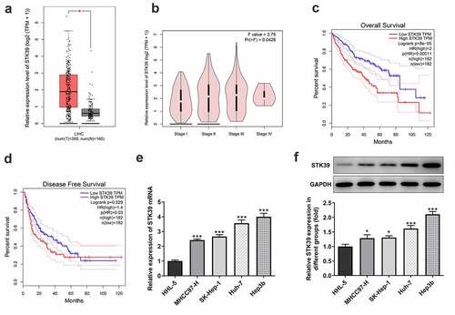 Figure 1. STK39 was up-regulated in HCC and predicts poor prognosis