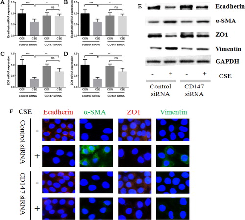 Figure 3. The effect of CD147 knockdown on CSE induced EMT markers expression in HBE cells. (a–d) Ecadherin (a), α-SMA (b), ZO1 (c) and Vimentin (d) mRNA expression in HBE cells transfected with control or CD147 siRNA and then treated by 10% CSE for 48 h; (e) Ecadherin, α-SMA, ZO1 and Vimentin protein expression in HBE cells transfected with control or CD147 siRNA and then treated by 10% CSE for 48 h; (f) representative images of Ecadherin (left panel), α-SMA (middle left panel), ZO1 (middle right panel) and Vimentin (right panel) protein expression in HBE cells by IF (All analyses were performed in triplicates, *p < 0.05; **p < 0.01; ***p < 0.001).