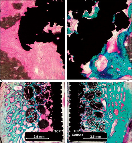 Figure 3. Representative histology from implant pair in the same dog. Left panels: engraftment with TCP granules. Encapsulation of implant with fibrous tissue. Right panels: engraftment with TCP granules with Colloss E added. Osseointegration of implant and ceramic granules.