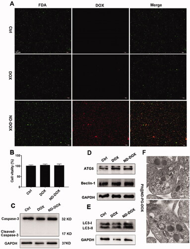 Figure 3. ND-DOX-loaded platelets maintained viability probably through induction of autophagy. (A) Microscopy of FDA staining of platelets loaded with ND-DOX or DOX. (B) Viability of platelets loaded with ND-DOX or DOX, assayed by CCK-8 test. (C–E) Western blot analysis of caspase-3, ATG5, Beclin-1 and LC-3 expression in platelets loaded with ND-DOX or DOX. (F) TEM observation of platelets loaded with ND-DOX (Plt@ND-DOX). White arrow marked was autophagosomes. Values were means ± SD (n = 3, * p < .05). Plt@ND-DOX refers to platelets loaded with ND-DOX.