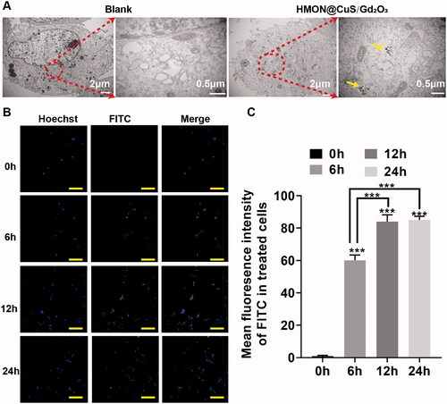 Figure 3. In vitro intracellular uptake detection. (A) TEM image of SKOV-3 cells; yellow arrows indicate nanoparticle locations. (B) CLSM images and fluorescence intensity profile analysis of SKOV-3 cells after treatment with FITC-labelled HMON@CuS/Gd2O3. Scale bar, 100 μm. *** p < .001.