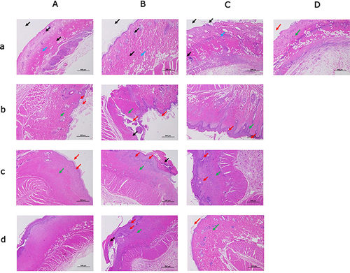 Figure 5 (a) He staining status of rats in each group at 7 days after scald. (b) He staining of rats in each group 14 days after scald. (c) He staining of rats in each group at 30 days after scald. (d) He staining status of rats in each group 45 days after scald.