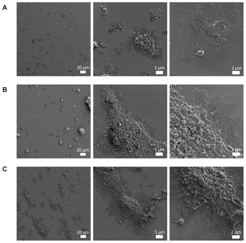 Figure 4 Representative micrographs of the surface of fibrinogen-coated polystyrene-coated quartz crystals as viewed by helium ion microscopy after the perfusion of platelet-rich plasma (A) and platelet-rich plasma in the presence of 10-nm silica nanoparticles (B) and 50-nm silica nanoparticles (C). Increased accumulation of platelet aggregates and bigger aggregates induced by the perfusion of platelet-rich plasma in the presence of silica nanoparticles is shown.