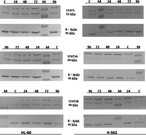 Figure 4. HL-60 and K-562 cells were cultured for 96 hours in the presence of MP (0.1 and 0.4 mM, respectively) also with non-treated control groups. Cell extracts were analyzed by western-blot analysis everyday in order to assess the content of STATs, β-actin was used as a loading control. The target STAT proteins showed no expressional change in K-562 cells but while STAT5A expression downregulated, STAT5B showed an increase at 96th hour in HL-60 cells. M: marker, C: control group, 24–96: time interval-study period.