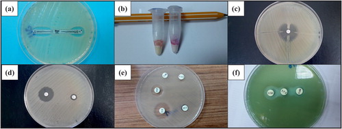 Figure 1. Representative test results. (a) A positive MBL gradient test (Etest); (b) positive and negative results of Rosco rapid CARB screen test; (c) a positive result of a modified Hodge test result; (d) a positive result of a combined EDTA disk diffusion test; (e) a Rosco MBL confirm test (positive result for imipenem EDTA and imipenem DPA test and negative result for meropenem DPA synergy test); and (f) a positive result of a double disk synergy test with DPA.