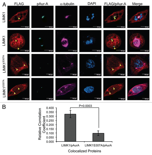 Figure 6 LIMK1 mutant did not colocalize with pAur-A. (A) Upper two parts: immunofluorescence analysis of LIMK1 (red) using anti-FLAG antibodies and pAur-A (green) in P69 cells transfected with LIMK1-FLAG constructs. Lower two parts: localization of LIMK1S307A using anti-FLAG antibodies and pAur-A in transfected P69 cells. Mitotic spindle and asters are shown by α-tubulin staining (magenta). DNA was counterstained with DAPI. Scale bar: 10 µm. (B) Relative correlation coefficient of the colocalized proteins as determined using the average value of two centrosomes per sample/cell. Results presented as mean ± SD of 10 individual cells from at least three independent experiments.