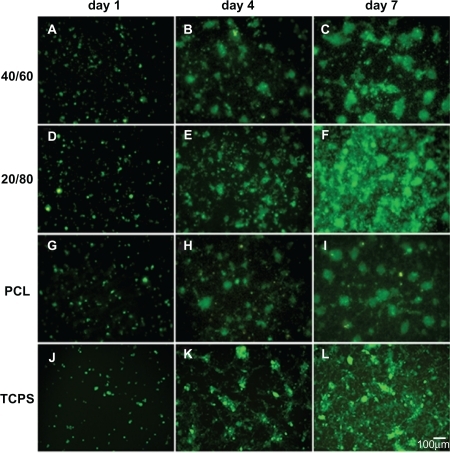 Figure 5 Fluorescent micrograph of mRPC density on CS-PCL/PCL (40/60) (A–C), CS-PCL/PCL (20/80) (D–F), PCL (G–I) nanofibrous scaffolds, and the cell culture plates (TCPS) (J–L) on day 1, 4, and 7 after incubation (green = endogenous GFP expression). Scale bar: 100 μm.Abbreviations: CS-PCL, cationic chitosan-graft-poly (ɛ-caprolactone); GFP, green fluorescent protein; PCL, polycaprolactone; mRPC, mouse retinal progenitor cell; TCPS, tissue culture polystyrene.