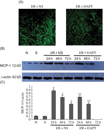 Figure 8. The expression of MCP-1 protein (A–C): (A) The expression of MCP-1 protein in the kidney at 24 h following IRI by immunofluorescence staining (original magnification ×400); renal IRI induced the increase of MCP-1 protein expression in the renal tubules; DAPT treatment reduced the expression of MCP-1 protein. (B) Immunoblot analysis of MCP-1 protein at 24 h, 48 h, and 72 h of post-reperfusion, respectively. (C) The density of the bands was quantified. Values presented are ratios of MCP-1 to β-actin, which was used as an equal protein loading marker. Results are presented as mean ± SEM (n = 5), *p < 0.05 versus respective sham. **p < 0.05 versus respective IR + NS at the same time point.