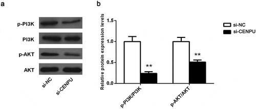 Figure 5. Downregulation of CENPU suppressed the PI3K/AKT signaling pathway.(a), Western blot analysis shows changes in the PI3K/AKT signaling pathway components in si-A549 cells. (b), Quantitative analysis of these proteins bands. The data are presented as the means ± SD from three independent experiments. **P < 0.01.