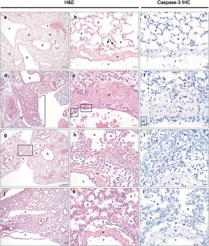 Figure 3. Pathological evaluation of lung tissues following intranasal exposure to ricin. Histopathology (h&e; left two columns) and cleaved caspase-3 IHC (right column) in the lungs of animals inoculated with (a–c) saline, (d–f) ricin, (g–i) ricin + PB10, or (j–l) ricin plus the PB10/SylH3 cocktail. In panels a-c, alveoli are fully expanded, often with alveolar macrophages in the alveolar space (b, arrows), and no evidence of caspase-3 activity. Following ricin treatment (panels d–f); lungs were congested, edematous, and with evidence of various degrees of hemorrhage (d, bracket). Note damage of endothelial cells in blood vessels (e, box), with concomitant neutrophilic infiltration of the vessel wall and perivascular spaces. Prominent cleaved caspase-3 staining was evident in the alveoli, while inflammatory cells infiltrating the perivascular space and blood vessel wall were present (f, box). In mice that received PB10 and ricin (g–i) there was focally extensive alveolar obliteration and interstitial inflammation in the perihilar region (g, box). Neutrophils infiltrating the blood vessel wall, perivascular space, and alveoli walls (h). Caspase 3 activity was limited and restricted to the perivascular space infiltrate and alveoli walls (i). In mice that received PB10/SylH3 and ricin (panels j–l) there was perihilar congestion (j) and infiltration of the perivascular space and alveoli walls by macrophages and rare neutrophils (k). Cleaved caspase 3 was rarely detected in these tissues (L). Legend: a, alveoli; b, bronchi/bronchioles airways; v, lumen of blood vessels; p, perivascular space; w, blood vessel wall. Cells positive for cleaved caspase 3 (c, f, i, and l) appear crimson. Magnification of images a, d, g, and j is 5x (bar, 100 μm). Magnification of other images is 50x (bar, 10 μm).