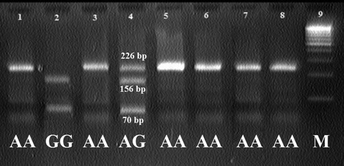Figure 2. PCR-RFLP electrophoretic analysis of the MC4R gene in Karachai sheep: AA genotype (226 bps); GG genotype (156 and 70 bps); AG genotype (226, 156, and 70 bps); Marker (100 bps).