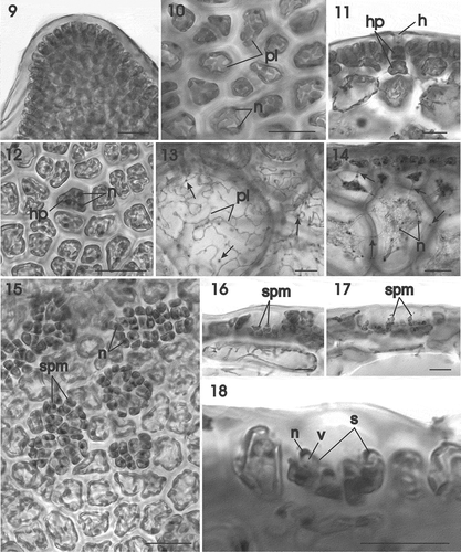 Figs 9–18. Gracilaria corallicola. Vegetative and male reproductive structures. Fig. 9. Apex of thallus in surface view (HGI–A 16242). Fig. 10. Outer cortical cells in surface view showing reticulate plastids and nuclei (HGI–A 10721). Fig. 11. Outer and inner cells of a hair primordium pit-connected to a deciduous hair (HGI–A 16798). Fig. 12. Multinucleate hair primordium in surface view (HGI–A 9645). Fig. 13. Medullary cells showing reticulate plastids containing many pyrenoid-like structures (arrows) (HGI–A 16509). Fig. 14. Multinucleate outer medullary cells linked by secondary pit connections between themselves and with cortical cells (arrows) (HGI–A 16242). Fig. 15. Surface view of thallus showing cortical cells producing uninucleate spermatangial parent cells bearing spermatangia (HGI–A 16312). Fig. 16. Young conceptacle with spermatangia (HGI–A 16312). Fig. 17. Confluent conceptacles containing spermatangia (HGI–A 16312). Fig. 18. Spermatangia bearing spermatia with a distal nucleus and proximal vesicle (HGI–A 16312). Abbreviations: h = hair; hp = hair primordium; n = nucleus; pl = plastid; s = spermatangium; spm = spermatangial mother cells ; v = vesicle. Scale bars: 20 µm. Haematoxylin.