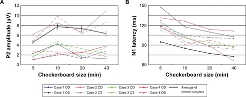 Figure 1 Plot of the A) P2 amplitude and B) N1 latency as a function of the size of the checks of the stimulus for the four patients. The average and the standard error of the means of normal subjects are plotted as the black line. The N1 latency was delayed in all eyes, while the P2 amplitude was reduced in all eyes except both eyes in case 2.