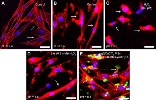 Figure 5 Confocal laser scanning microscopy (CLSM) images of shape of osteoblasts cultured under different conditions.Notes: (A) At pH = 7.4, without H2O2; (B) at pH = 5.5, without H2O2; (C) at pH = 5.5, 80 μM H2O2; (D) at pH = 5.5, 80 μM H2O2, 0.8 μM Lys; (E) at pH = 5.5, 80 μM H2O2, Lys@CaCO3 MSs (containing 0.8 μM Lys). The scale bars are 30 μm. Arrows in A–D indicate the classical cells under each condition. Arrows in E indicate the CaCO3 MSs.Abbreviations: Lys, L-lysine; MSs, microspheres.