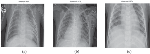 Figure 9. Chest-xray classification-1st stage results using (a) EfficientNet-b0, (b) SqueezeNet, (c) ResNet-50.