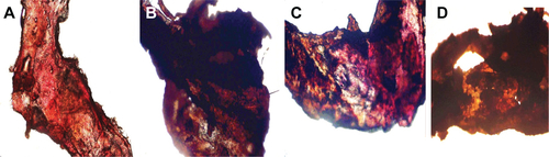 Figure S3 The morphology of the arterial thrombus in mouse model.Notes: (A) Abdominal aorta of health mouse; (B) abdominal aorta of mouse treated with NS; (C) abdominal aorta of mouse treated with 167 μmol/kg aspirin; (D) abdominal aorta of mouse treated with 10 nmol/kg IQCA-TAVV.Abbreviations: IQCA-TAVV, N-(3S-1,2,3,4-tetrahydroisoquinoline-3-carbonyl)-Thr-Ala-Arg- Gly-Asp(Val)-Val; NS, normal saline.