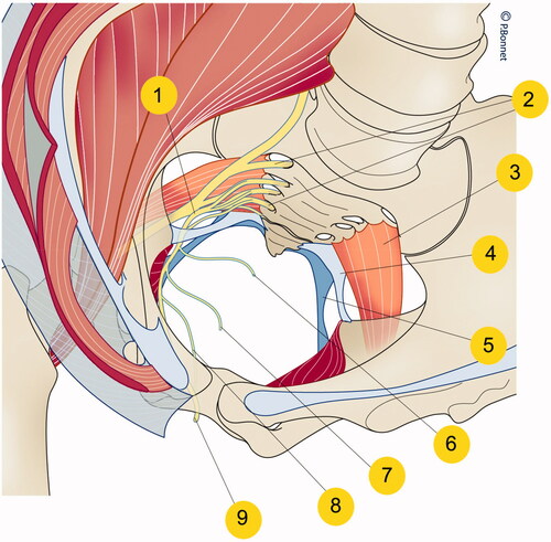 Figure 1. Pudendal nerve anatomy, anterior-cranial point of view. 1: pudendal nerve, 2: sacral nerve roots, 3: piriformis muscle, 4: sacrospinous ligament, 5: sacrotuberous ligament, 6: inferior rectal nerve, 7 + 8: perineal nerves, 9: dorsal nerve of the penis/clitoris (© P.Bonnet).