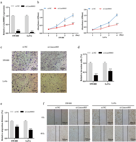 Figure 2. Influence of Linc00883 on CRC cell proliferation, invasion, and migration. Si-Linc00883 and its corresponding control were transfected into CRC cell lines SW480 and LoVo. (a) Analysis of the Linc00883 expression in CRC cells by qRT-PCR. (b) Cell Counting Kit-8 (CCK-8) was applied to analyze CRC cell proliferation. (c-d) The CRC cell invasion was assessed using a transwell assay (Scale bar: 100 μm). (e-f) A wound-healing experiment was carried out to detect CRC cell migration (Scale bar: 200 μm). **P < 0.01, ***P < 0.001 vs. si-NC. NC: Negative control. All experiments were performed at least in triplicate.