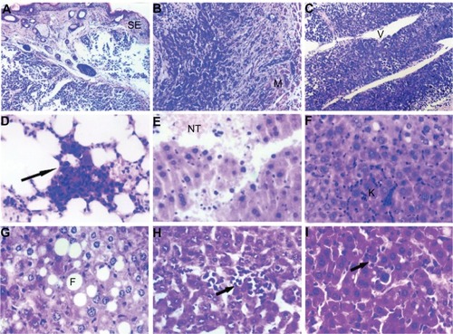 Figure 2 (A) Animal model control group with tumor cell wear through skin squamous epithelium, HE × 120. (B) Animal model control group with tumor cell invasion to skeletal muscles, HE × 120. (C) Animal model control group with tumor cells actively around blood vessels, HE × 120. (D) Animal model control group showing pulmonary metastasis, HE × 460. (E) Cyclophosphamide group with hemorrhage and necrotic tissue in liver, HE × 460. (F) Chalone 19-peptide group showing hydropic degeneration in hepatic cells, HE × 460. (G) Cyclophosphamide 100 mg/kg and Chalone 19-peptide combined treatment group showing fatty degeneration of tumor cells, HE × 460. (H) Cyclophosphamide 50 mg/kg and Chalone 19-peptide combination treatment group showing punctuate phagocytic infiltration, HE × 460. (I) Control group with slight phagocytic infiltration, HE × 460.