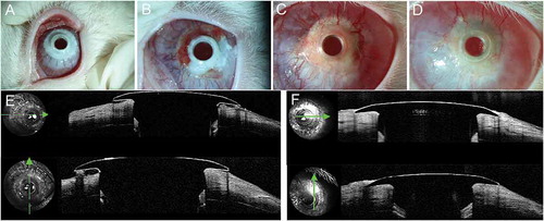 Figure 8. Implanted chondro-Kpro in rabbit 5. A. Left eye 3 days after Kpro implantation. B. Fibrovascular tissue was observed over the carrier cartilage 24 days postoperatively. C. Left eye 3 months after Kpro implantation. D. Left eye 8 months after Kpro implantation. No obvious RPM was observed. E. AS-OCT showed a gap between the carrier cartilage and posterior surface of the anterior plate 1 month postoperatively, and the gap was connected to the ocular surface. F. AS-OCT scan of the junction between Kpro and the cartilage 8 months postopertively; the gap disappeared, and the edge of the anterior plate was covered by epithelial tissue.
