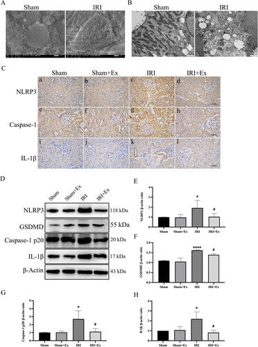 Figure 4. HucMSC-Ex inhibits renal pyroptosis in vivo. (A) Representative scanning electron micrographs of pyroptosis in kidney. (B) Representative transmission electron microscopes of pyroptosis in kidney. (C) Immunohistochemical analysis of each group’s kidney. (a–d) Immunohistochemical analysis of NLRP3. (e–h) Immunohistochemical analysis of caspase-1. (i–l) Immunohistochemical analysis of IL-1β. (D–H) Western blot analysis of NLRP3, GSDMD, caspase-1 p20, and IL-1β expression in each group (n = 3). The values are presented as the mean ± SD. *p < 0.5, ****p < 0.001 vs. sham group; #p < 0.5 vs. IRI group. Sham + Ex: sham + hucMSC-Ex; IRI + Ex: IRI + hucMSC-Ex.