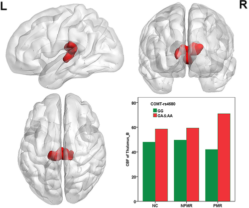 Figure 2 Main effect of COMT Met allele on the CBF of the whole brain. The histograms exhibit the numerical representation of the CBF of the thalamus. The CBF of bilateral thalamus was significant increased in Met allele carriers.