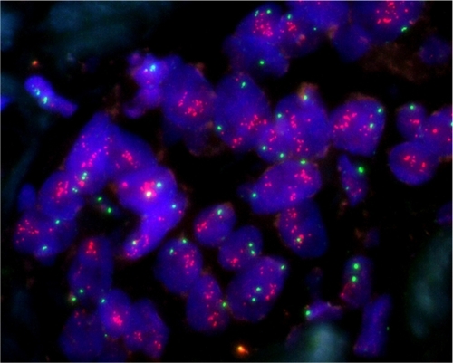 Figure 1 TOP2A amplified cells.