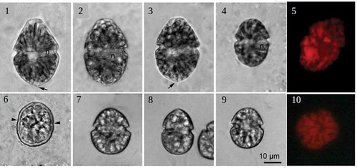 Figs 1–10. Gymnodinium species, light microscopy. Figs 1–6. Gymnodinium baicalense. Figs 1–3. Large cells. Note small protrusion (arrow) and the nucleus (n). Fig. 4. Small cell. Fig. 5. Epifluorescence microscopy displaying numerous chloroplasts Fig. 6. Cyst of G. baicalense; paracingulum is marked by arrowheads. Figs 7–9. Cells of G. corollarium from the monoculture. Fig. 10. Epifluorescence microscopy displaying numerous chloroplasts in G. corollarium.