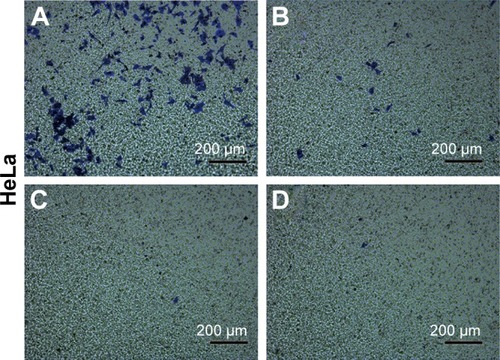 Figure 6 Representative images of the HeLa cell migration induced by CuS@SiO2 NPs (80 μg/mL) with or without SRC/FAK inhibitors evaluated by a transwell migration assay. (A) Medium only group; (B) 80 μg/mL CuS@SiO2 NPs; (C) CuS@SiO2 NPs with 1 ng/mL FAK inhibitor; (D) CuS@SiO2 NPs with 1 ng/mL SRC inhibitor. Original magnification, ×100.Abbreviations: FAK, focal adhesion kinase; NP, nanoparticle.