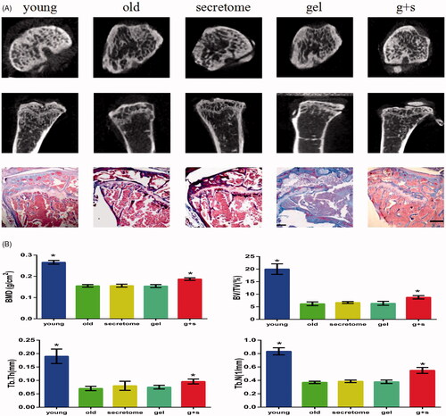 Figure 5. Micro-CT and Masson trichrome staining analysis of tibias from different groups. (A) Representative images from micro-CT and Masson staining of trabecular bone from the tibias. Scale bar =500 μm. (B) Bone characteristics were analyzed through bone mineral density (BMD), trabecular bone volume/total tissue volume (BV/TV), trabecular thickness (Tb.Th), and trabecular number (Tb.N). *p < .05 vs old group.