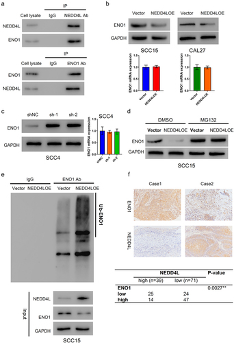 Figure 4. NEDD4L bound to ENO1 and induced its ubiquitination. (a) Co-immunoprecipitation results showing direct association between NEDD4L and ENO1. (b) ENO1 protein (top) and mRNA (bottom) levels in OSCC cells with or without NEDD4LOE transduction. (c) ENO1 protein (left) and mRNA (right) levels in OSCC cells with or without NEDD4L interference. (d) Western blot results showing ENO1 protein level in OSCC cells with or without NEDD4LOE transduction and with or without MG132 treatment. (e) Western blot results of ENO1 from OSCC cells with or without NEDD4LOE. (f) IHC analysis of paraffin sections from patients, staining ENO1 and NEDD4L. Case 1 represents high ENO1 and low NEDDL4, while Case 2 represents low ENO1 and high NEDDL4 (upper). A negative correlation between ENO1 and NEDD4L expression was identified using Fisher’s exact test (bottom).