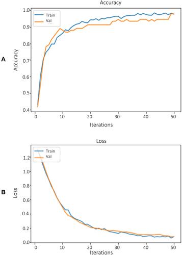 Figure 10 Training and validation performance of EfficientNetB0 model for cervical cancer type classification (A) Accuracy and (B) Loss.