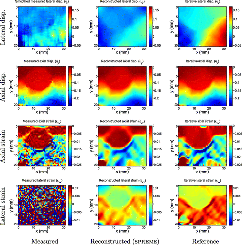 Figure B3. Displacement and strain images for fibroadenoma 4.