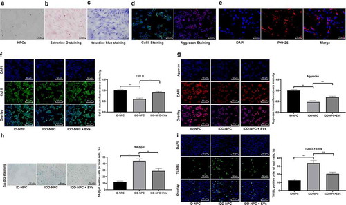 Figure 3. BMSCs-EVs promote proliferation of NPCs and inhibit apoptosis. (a), representative image of primary NPCs (× 200); (b), representative image of safranine O staining (× 200); (c), representative image of toluidine blue staining (× 200); (d), immunofluorescence of col II and Aggrecan represented for typical NPCs marker (× 200); (e), fluorescence microscopy showing the uptake of EVs labeled with the red fluorescent dye PKH26 (× 200); (f,g), Immunofluorescence of col II and Aggrecan (× 200); H, SA-βgal staining was utilized for NPC senescence measurement; and blue represented senescent cells; (i), TUNEL staining were performed to measure apoptosis index; green indicates TUNEL-positive cells, blue indicates nucleus (× 200). Three independent experiments were performed. Data are expressed as mean ± s.d. One-way ANOVA and Tukey’s multiple comparisons test were used to determine statistical significance. **p < 0.05