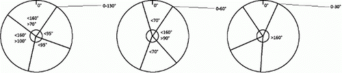 Figure 4.  Three examples of typical whorl patterns, from the Swedish Pine Stem Bank, for whorls with four knots. This figure shows the cross-sectional view of a log, seen from the top end. Note: The zero-degree direction corresponds to north in the standing tree. Each straight line corresponds to the cardinal direction, at the pith, of a knot. The uppermost right degree-interval limits the direction of the first knot, clock-wise, from the northern direction. All other degree-intervals limit the angular distances between knots.