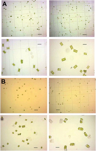Figure 3. Cell morphology of C. vulgaris H1993 (up) and D. communis H552 (down) in urea supplemented medium (right) and BBM (left) at day 15 (panel A) and day 29 (panel B).Note: Scale bar is 20 µm; 40x magnification.