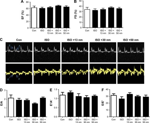 Figure 4 The effects of AuNPs on cardiac function.Notes: (A) Left ventricular EF and (B) FS were measured to reflect cardiac contraction function. (C) Representative Doppler echocardiographic images. (D) E/A, (E) E′/A′ (F) and E/E′ ratios were used to reflect cardiac diastolic function. No significance was found.Abbreviations: EF, ejection fraction; FS, fractional shortening; AuNPs, gold nanoparticles; ISO, isoproterenol; Con, control.