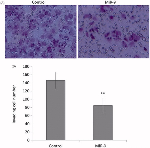 Figure 5. MiR-9 inhibits OSCC cell invasion. Cells transfected with miR-9 mimics and miRNA control were starved overnight and then seeded in the Transwell chambers coated with Matrigel for invasion assay. Following a 24 h-culture, non-invading cells in the upper chamber were removed and invading cells were stained and calculated in four microscopic fields per sample. Details are described in the “Materials and methods”. Shown are representative images of invading cells (A). The bar graphs (B), corresponding to upper panels, show mean ± SD of the numbers of invading cells from three independent experiments. **p < .01.