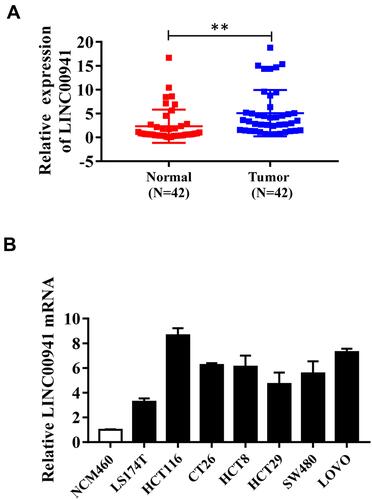 Figure 1 LINC00941 expression is increased in colon cancer tissues and cell lines. (A) LINC00941 expression in colon cancer and adjacent normal tissues was detected by RT-qPCR. (B) LINC00941 expression in colon cancer cell lines LS174T,HCT116,CT26, HCT8, HCT29, SW480 and LoVo compared colonic epithelial cells NCM460 was detected by RT-qPCR. **P < 0.01.