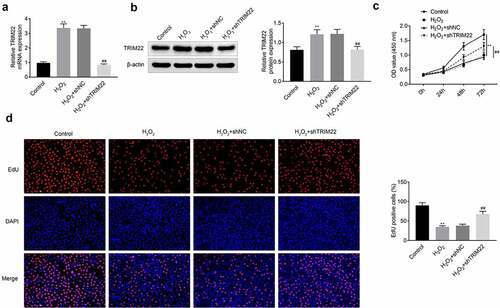 Figure 2. Knockdown of TRIM22 suppressed the proliferation of lens epithelial cells. (a, b) The expression of TRIM22 in lens epithelial cells was determined with the RT-PCR and western blotting. (c) CCK-8 was performed for the detection of the proliferation of lens epithelial cells. (d) EdU assays were performed for the detection of the proliferation of lens epithelial cells. ** p < 0.01, ## p < 0.05 (H2O2+ shNC vs H2O2+ TRIM22)