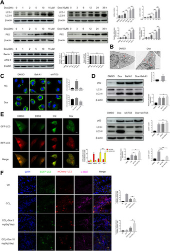 Figure 4 Doxazosin inhibits autophagy in hepatic stellate cells. (A) The levels of autophagy-related proteins (LC3B, p62, ATG5 and Beclin 1) in LX-2 cells were determined by immunoblotting. (B) Representative transmission electron microscopy images of autophagosomes (arrow) in LX-2 cells treated with doxazosin (10 μM) or DMSO. Scale bar, 1 μm. (C) LX-2 cells were infected with GFP-LC3 adenovirus and then transfected with the indicated siRNAs or treated with the indicated chemicals. GFP-LC3 puncta were evaluated by confocal microscopy. Scale bar, 20 μm. (D) The protein levels of LC3B and p62 in LX-2 cells were determined by immunoblotting. (E) LX-2 cells were infected with GFP-RFP-LC3 adenovirus and then treated with the indicated chemicals. GFP-LC3 and RFP-LC3 puncta were evaluated by confocal microscopy. Scale bar, 20 μm. (F) Representative images of punctate mCherry-EGFP-LC3 staining in liver tissues. Red: mCherry-LC3; green: EGFP-LC3; purple: α-SMA; blue: nucleus. Scale bar, 20 μm.