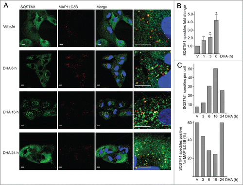 Figure 2. The number of SQSTM1-positive protein speckles in ARPE-19 cells increases after DHA supplementation. (A) Immunostaining for SQSTM1 and MAP1LC3B after DHA (70 µM) treatment for indicated time points. Nuclear DNA was stained using Draq5 (5 µM). Scale bar: 10 µm. (B) Cells were treated with vehicle (V) or DHA (70 µM) for 1, 3, and 6 h. The SQSTM1-positive speckles were automatically quantified using ScanR automated image acquisition. The quantification displayed are representative for 3 independent experiments from where 2 are automatically quantified for more than 1,000 cells per condition and one is manually counted. *) indicates significantly different from control, Student t test P < 0.05. (C) The number of SQSTM1-positive speckles per cell (upper panel) and SQSTM1 speckles positive for MAP1LC3B (lower panel) in ARPE-19 cells supplemented with vehicle (V) or DHA (70 µM) for the indicated time points. The quantification displayed was performed manually for more than 100 cells per condition from one representative experiment. This quantification is representative for 3 independent experiments.