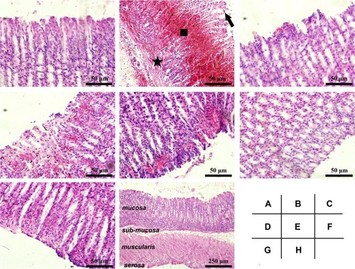 Figure 5 Histological details of the gastric mucosa in Wistar rats. The microscopic examination was performed on the gastric mucosa obtained from different groups: (A) Control, (B) Model, (C) Sucralfate, (D) BCM, (E) L-Se, (F, H) M-Se and (G) H-Se. Briefly, Wistar rats were treated as presented in Table 1, and they were sacrificed after the ethanol challenge. The stomach was immediately obtained, part of which was quickly fixed in formaldehyde solution, routinely embedded by paraffin, sectioned (5 μm thick) and finally stained by hematoxylin and eosin (H&E) duel-dye. The Sections were examined under a light microscope. Typical gastric mucosal damage including epithelial exfoliation (arrow), mucosal hemorrhage (square) and inflammatory cell infiltration (star) was found in Model group. (A–G) magnification, × 200; (H) magnification, × 40.