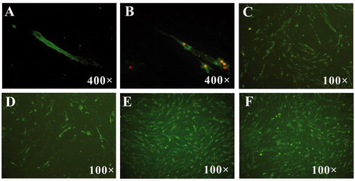 Figure 4. Effect of DG and STS on cell apoptosis revealed by fluorescence staining. The red fluorescence and green fluorescence presented the late apoptosis and the early apoptosis, respectively. (A) Early apoptotic cells, only green fluorescence was found around cell membrane; (B) late apoptotic and necrotic cells, green fluorescence was found around cell membrane and red fluorescence in nucleus; (C) cell control; (D) virus control; (E) cells treated with DG and MDV; (F) cells treated with STS and MDV.