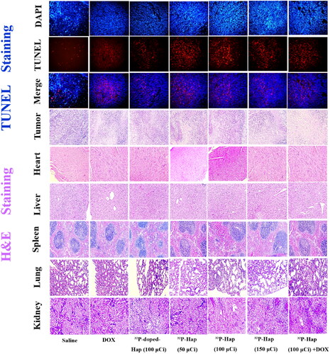 Figure 4. Representative images of TUNEL stained tumor slices, and H&E stained tumor, heart, liver, spleen, lung and kidney slices isolated from bone tumor-bearing Balb/c mice on day 21.
