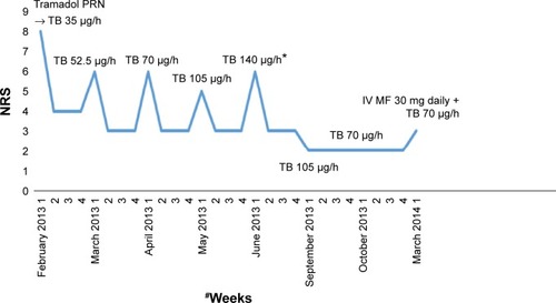 Figure 2 Pain intensity and TB doses in a patient diagnosed with thyroid carcinoma and bone metastases.
