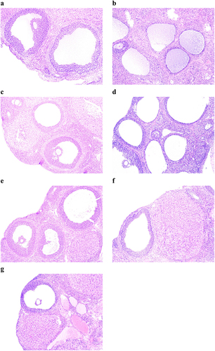 Figure 4 Ovary morphology of rats in each group. (a) Ovary morphology of rats in the blank group (n=6), (b) Ovary morphology of rats in the model group (n=12). After the drug intervention, morphological changes of ovarian tissue of rats in each group (100x, (c) Ovary morphology of rats in the blank group (n=8); (d) Ovary morphology of rats in the Letrozole group (n=8); (e) Ovary morphology of rats in the pioglitazone group (n=8); (f) Ovary morphology of rats in the acarbose group (n=8); (g) Ovary morphology of rats in the metformin group (n=8).).