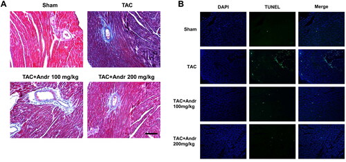 Figure 3. Andr attenuates cardiac fibrosis and reduces cardiac cell apoptosis in TAC mice. (A) Representative images of Masson’s trichrome staining of the hearts of mice in the sham, TAC, TAC + Andr 100 mg/kg and TAC Andr 200 mg/kg groups. Scale bar = 100 μm. Representative photomicrographs of TUNEL staining in the rat hearts. Scale bar = 20 μm.