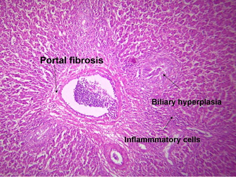 Figure 2. Liver of the AF group of 42-day-old broiler chickens showing portal inflammatory cell infiltration, moderate portal fibrosis and biliary hyperplasia (H&E × 400).